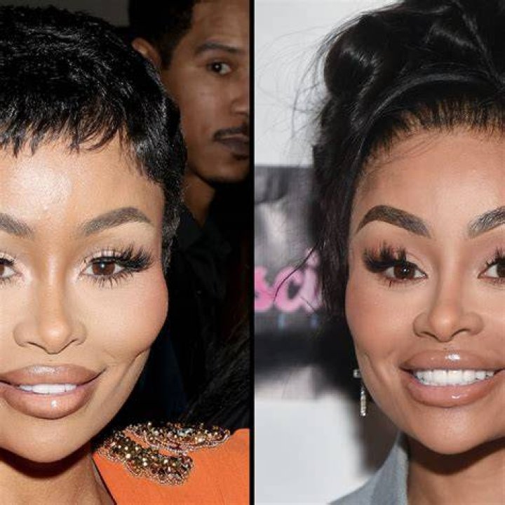 Blac Chyna Before And After: Unlocking The Transformation