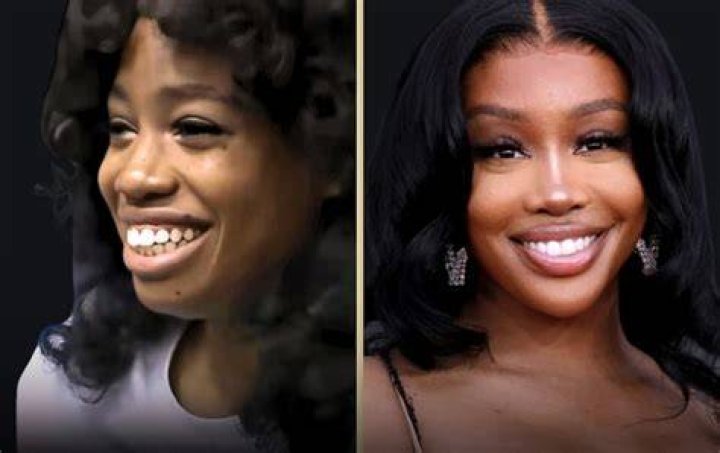 SZA Confirms the Plastic Surgery Procedure She’s Had Done, Explains Why