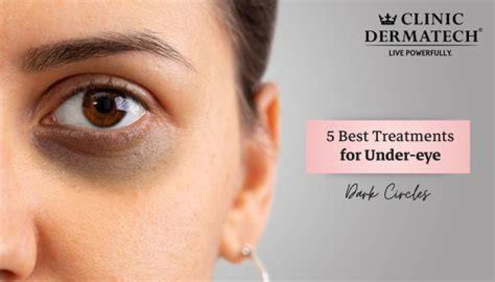 Unveiling The Enigma Of Jimmy Smits' Dark Under-Eye Circles: Unlocking Insights And Discoveries